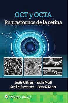 Papel OCT y OCTA en Trastornos de la Retina
