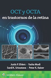 E-book Oct Y Octa En Trastornos De La Retina