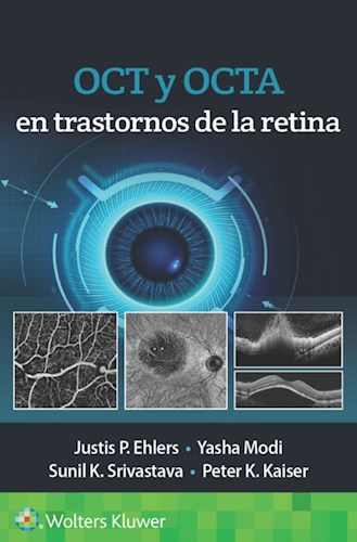  Oct Y Octa En Trastornos De La Retina (Ebook)