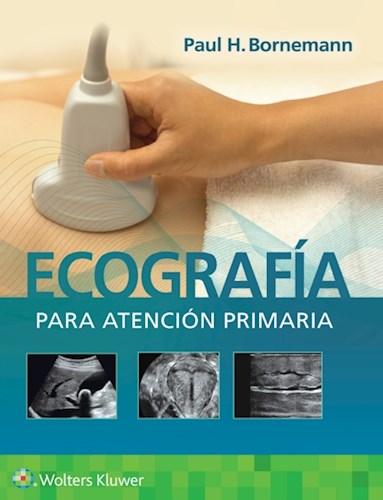  Ecografía Para Atención Primaria (Ebook)