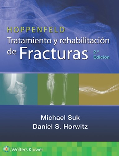 E-book Hoppenfeld. Tratamiento y rehabilitación de fracturas