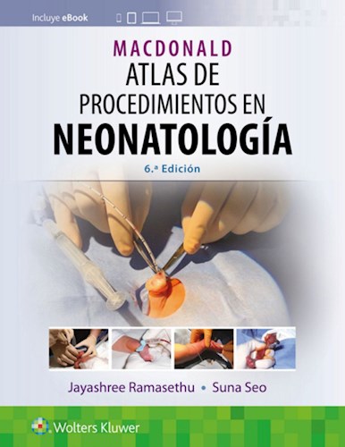 E-book MacDonald. Atlas de procedimientos en neonatología