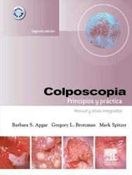 E-book Colposcopia. Principios Y Práctica