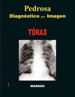 Papel Torax, Diagnostico por Imagenes (tapa dura) 1