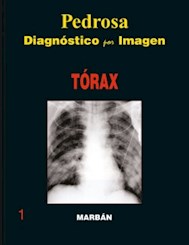 Papel Torax, Diagnostico Por Imagenes (Tapa Dura) 1