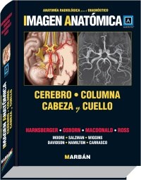 Papel Imagen Anatomica Cerebro, Columna Cabeza y Cuello
