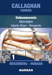 Papel Callaghan Cadera T1. Osteonecrosis