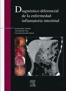 Papel Diagnóstico Diferencial de la Enfermedad Inflamatoria Intestinal
