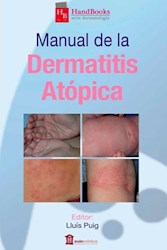 Papel Manual De La Dermatitis Atópica