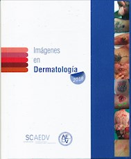 Papel Imágenes En Dermatología