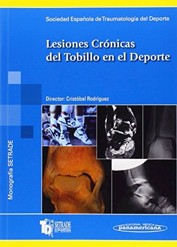 Papel LESIONES CRONICAS DEL TOBILLO EN EL DEPORTE