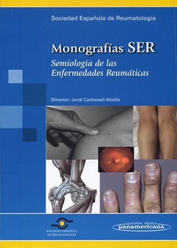 Papel MONOGRAFIAS SER SEMIOLOGIA DE LAS ENFERMEDADES REUMATICAS