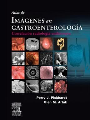 E-book Atlas de imágenes en gastroenterología