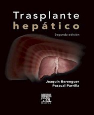 E-book Trasplante Hepático