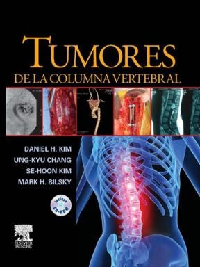 E-book Tumores de la columna vertebral