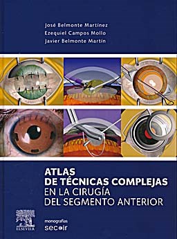 Papel Atlas de Técnicas Complejas en la Cirugía del Segmento Anterior