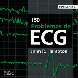Papel 150 Problemas de ECG Ed.4