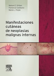 E-book Manifestaciones Cutáneas De Neoplasias Malignas Internas