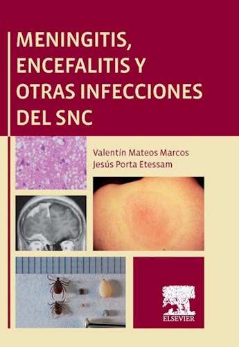 E-book Meningitis, encefalitis y otras infecciones del SNC