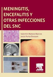 E-book Meningitis, Encefalitis Y Otras Infecciones Del Snc