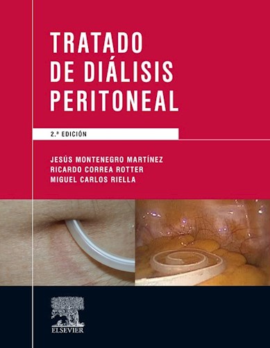 Papel Tratado de Diálisis Peritoneal Ed.2