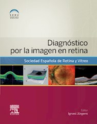 E-book Diagnóstico Por La Imagen En Retina