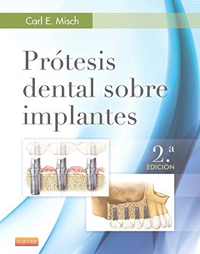 Papel Prótesis Dental sobre Implantes Ed.2