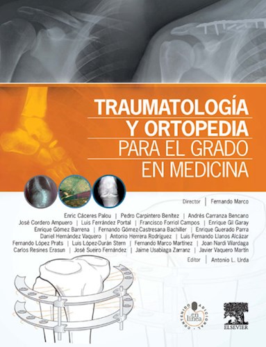  Traumatología Y Ortopedia Para El Grado En Medicina