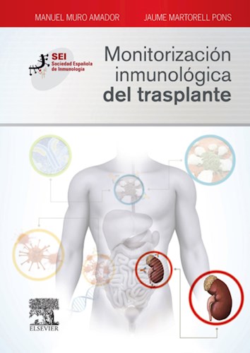 E-book Monitorización inmunológica del trasplante