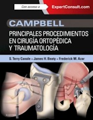 Papel Campbell. Principales Procedimientos En Cirugía Ortopédica Y Traumatología