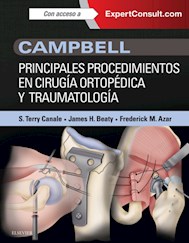E-book Campbell. Principales Procedimientos En Cirugía Ortopédica Y Traumatología