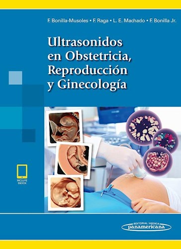 Papel Ultrasonidos en Obstetricia, Reproducción y Ginecología