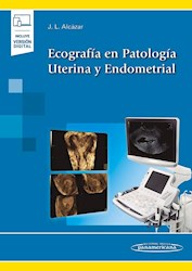 Papel Ecografía En Patología Uterina Y Endometrial