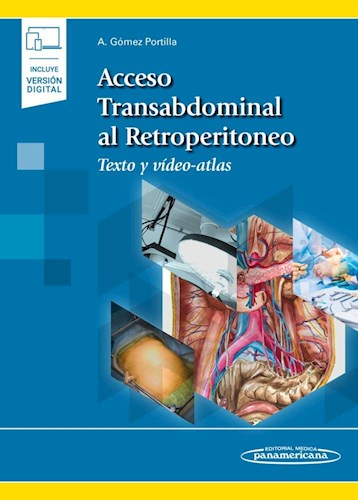 Papel Acceso Transabdominal al Retroperitoneo