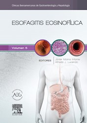 E-book Esofagitis Eosinofílica