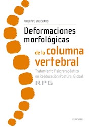 Papel Deformaciones Morfológicas De La Columna Vertebral