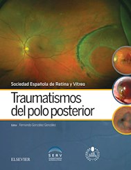E-book Traumatismos Del Polo Posterior