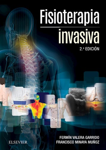 E-book Fisioterapia invasiva