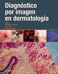 E-book Diagnóstico Por Imagen En Dermatología