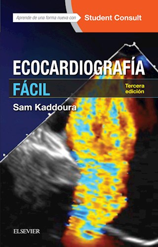 E-book Ecocardiografía fácil