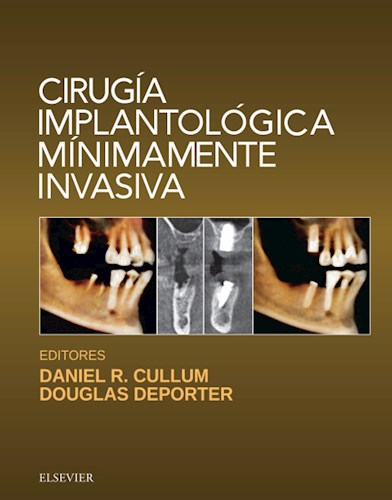  Cirugía Implantológica Mínimamente Invasiva
