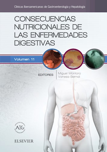 E-book Consecuencias nutricionales de las enfermedades digestivas