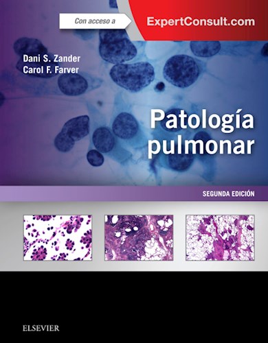 E-book Patología pulmonar