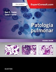 E-book Patología Pulmonar