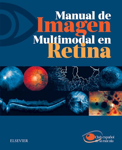 E-book Manual de Imagen Multimodal en Retina (eBook)