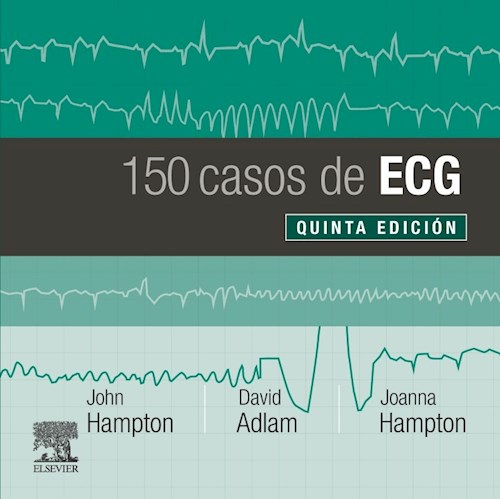 Papel 150 casos de ECG Ed.5