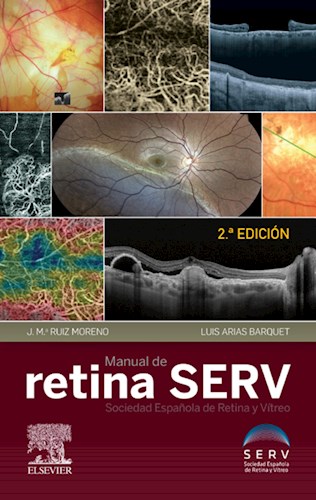  Manual De Retina  Serv Ed 2 (Ebook)