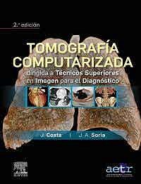 Papel Tomografía Computarizada Ed.2