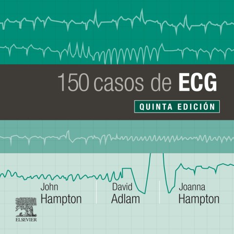 E-book 150 casos de ECG
