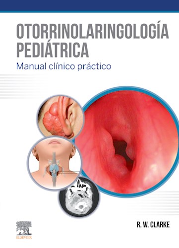  Otorrinolaringología Pediátrica (Ebook)